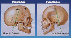 Skull Diagram