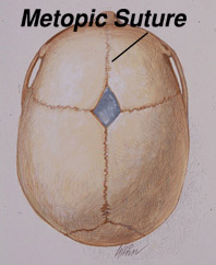 Metopic Suture Diagram